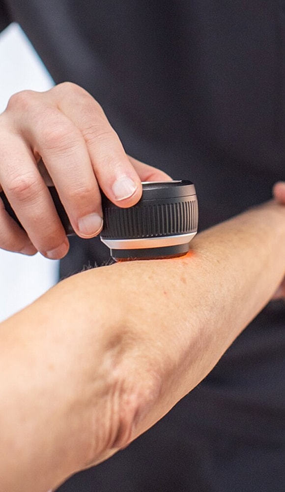 Hand applying device on forearm skin.