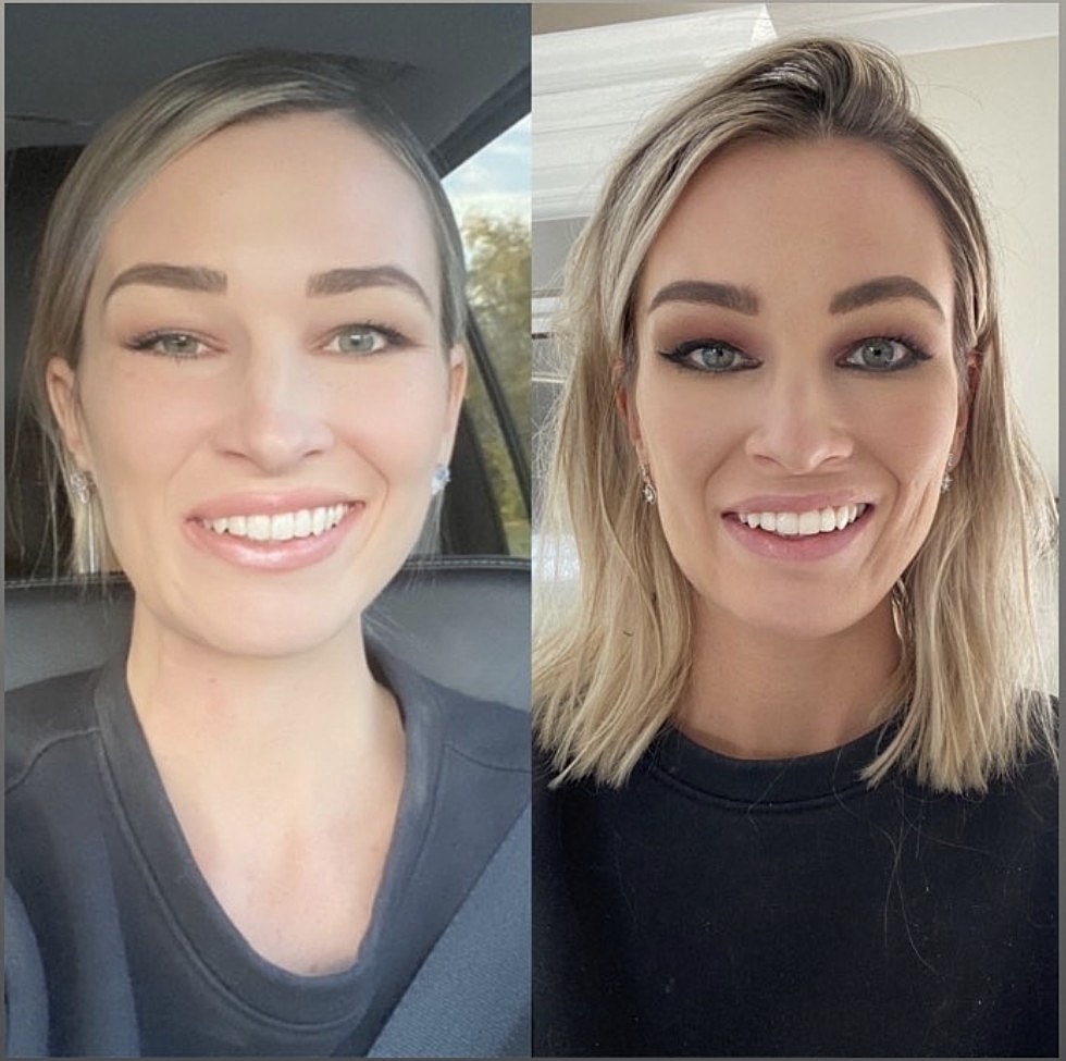 Close-up of textured skin on a hand.